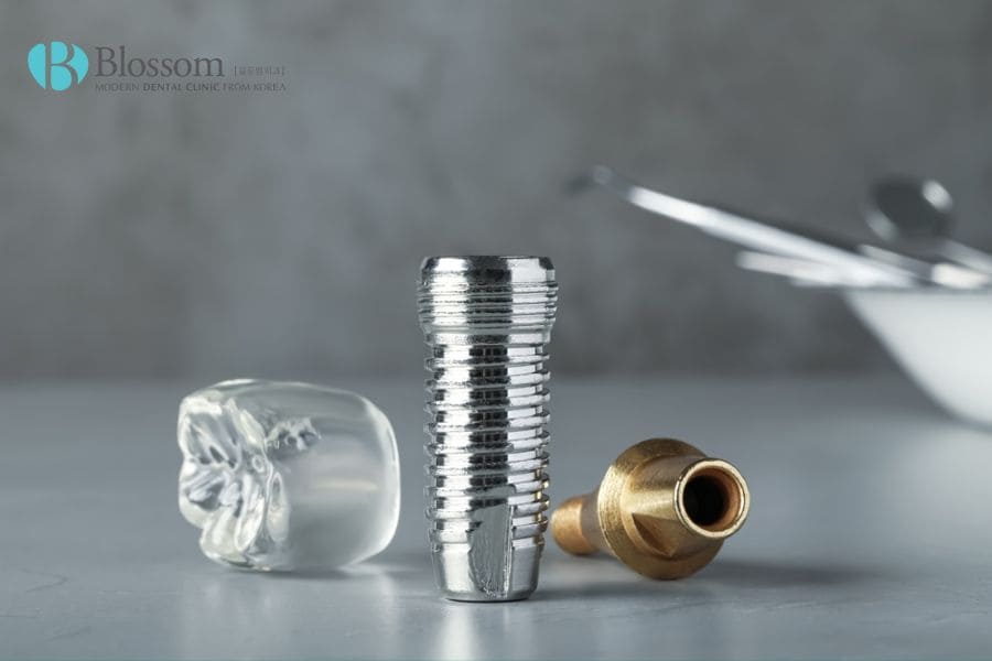 Cấy ghép Implant là gì? Những thông tin cần biết 3 cay ghep implant 2