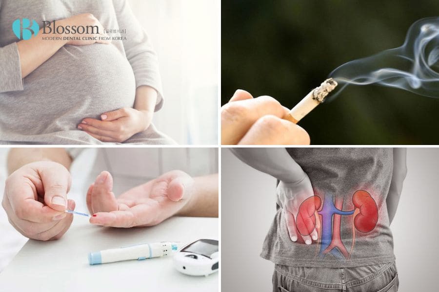 Cấy ghép Implant là gì? Những thông tin cần biết 6 cay ghep implant 5