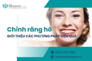 Giới thiệu các phương pháp chỉnh răng hô hiệu quả trong nha khoa