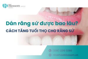 Dán răng sứ được bao lâu? Cách tăng tuổi thọ cho răng sứ