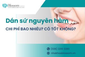 Dán sứ nguyên hàm: Chi phí và những điều cần biết