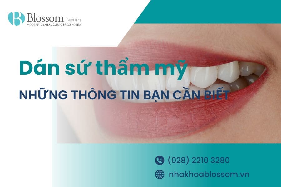 Dán sứ thẩm mỹ là gì? Những thông tin cần biết
