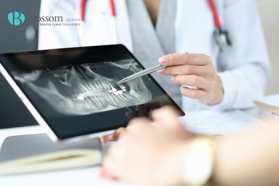 Top 11 địa chỉ làm răng Implant uy tín, bác sĩ tay nghề cao 13 dia chi lam rang implant uy tin 12