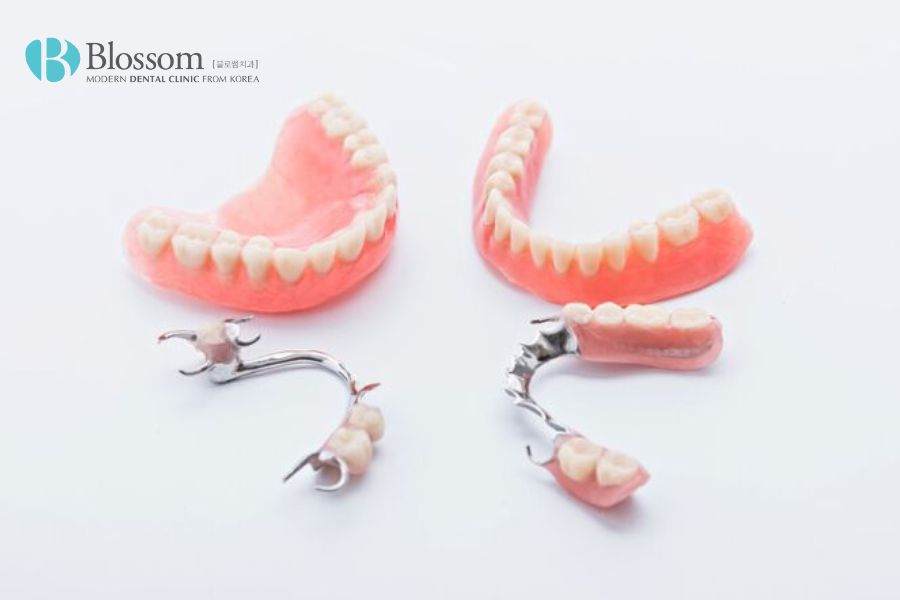 Hàm răng giả tháo lắp là gì? Ưu, nhược điểm và lưu ý sử dụng 3 ham rang gia thao lap la gi 2
