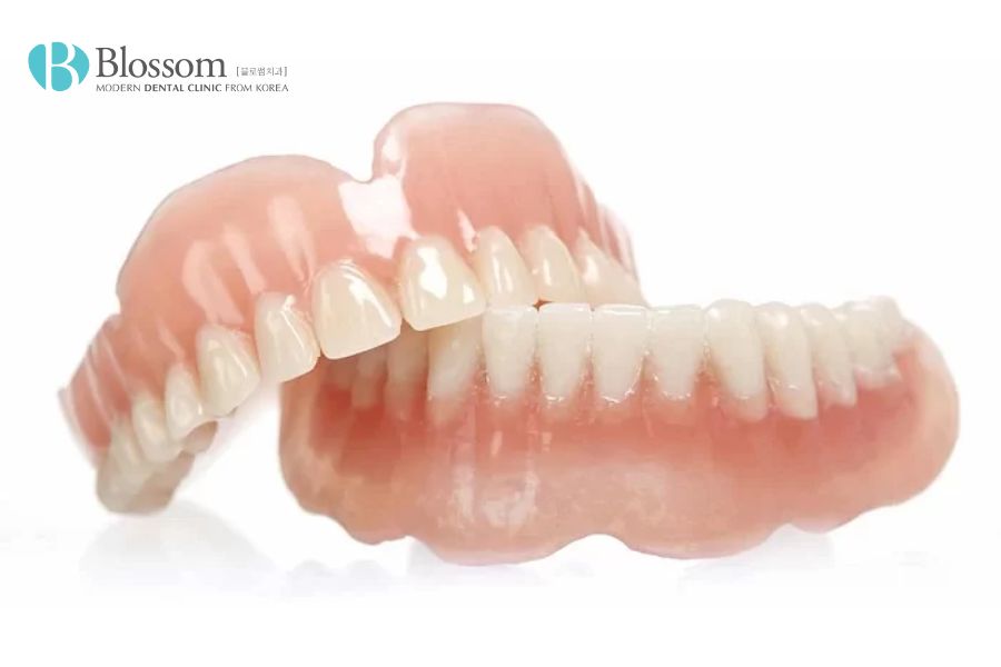 Hàm răng giả tháo lắp là gì? Ưu, nhược điểm và lưu ý sử dụng 2 ham rang gia thao lap la gi 3