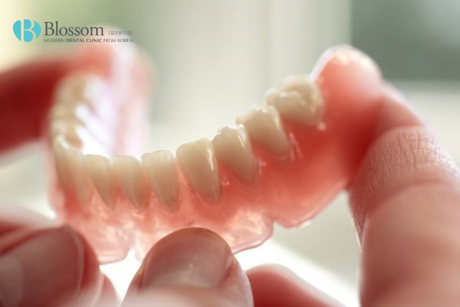 Hàm răng giả tháo lắp là gì? Ưu, nhược điểm và lưu ý sử dụng 5 ham rang gia thao lap la gi 4