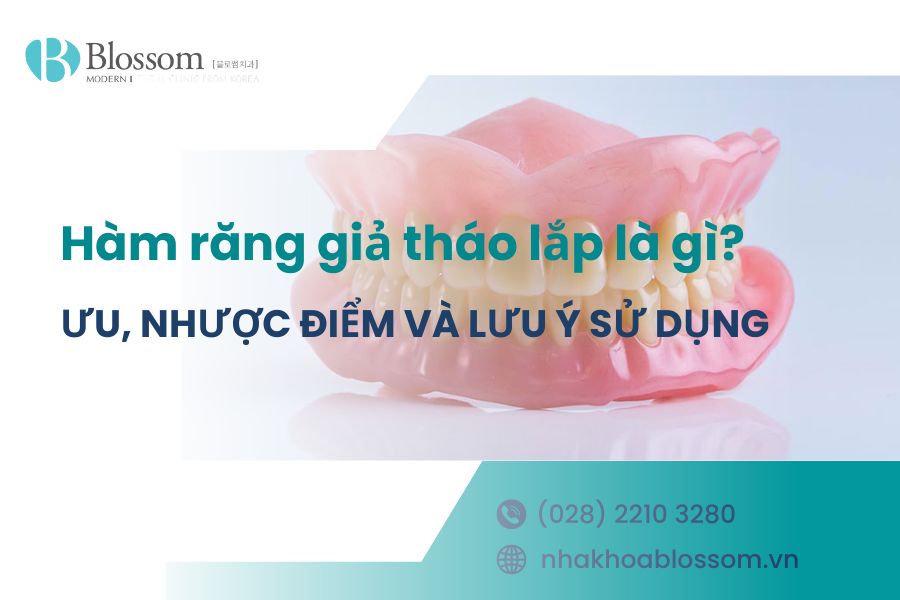 Hàm răng giả tháo lắp là gì? Ưu, nhược điểm và lưu ý sử dụng