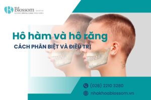 Cách phân biệt và phương pháp điều trị hô hàm và hô răng