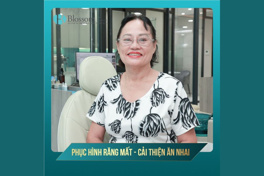 Tổng hợp 9 kinh nghiệm trồng răng Implant hiệu quả 11 kinh nghiem trong rang implant 10