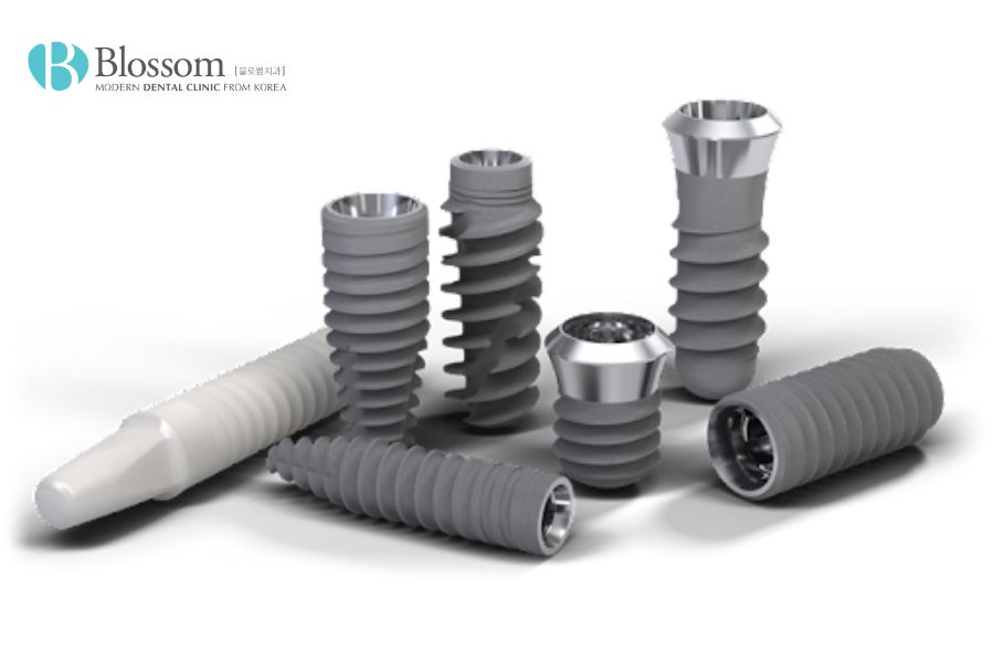 Tổng hợp 9 kinh nghiệm trồng răng Implant hiệu quả 4 kinh nghiem trong rang implant 3