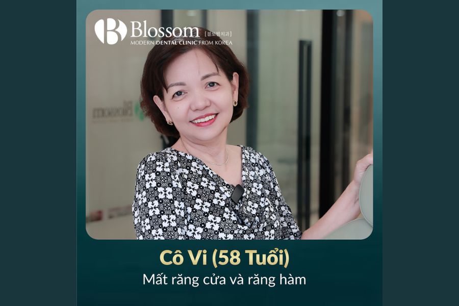 Tổng hợp 9 kinh nghiệm trồng răng Implant hiệu quả 10 kinh nghiem trong rang implant 9