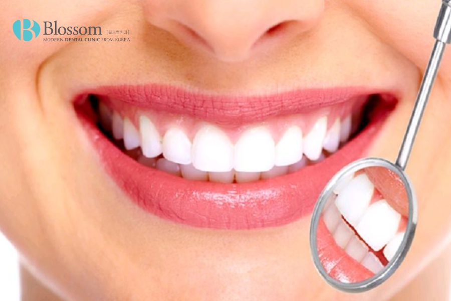 Kỹ thuật trồng răng sứ: Quy trình an toàn, chuẩn xác với 5 bước 2 ky thuat trong rang su 1