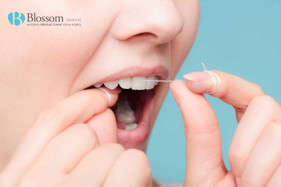 Kỹ thuật trồng răng sứ: Quy trình an toàn, chuẩn xác với 5 bước 6 ky thuat trong rang su 5