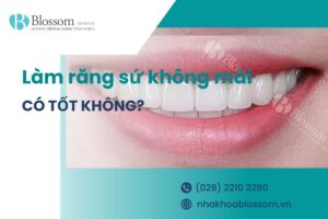 Làm răng sứ không mài có tốt không? Ưu điểm, chi phí và những thông tin cần lưu ý
