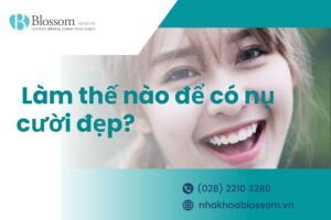 Nụ cười đẹp là như thế nào? Làm thế nào để có nụ cười đẹp?
