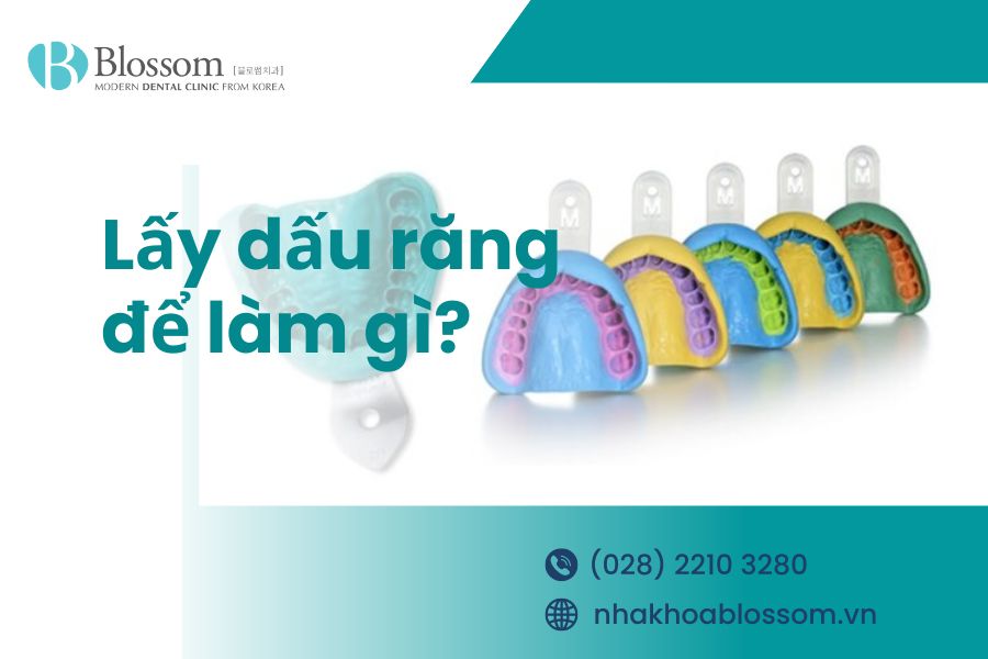 Lấy dấu răng để làm gì? Lợi ích lấy dấu răng 1 lay dau rang de lam gi thumbnail