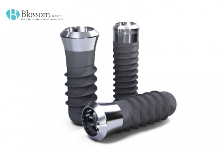 Loại Implant nào là tốt nhất hiện nay? - Nha Khoa Blossom 3 loai implant nao la tot nhat 2