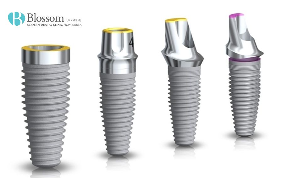 Loại Implant nào là tốt nhất hiện nay? - Nha Khoa Blossom 7 loai implant nao la tot nhat 6