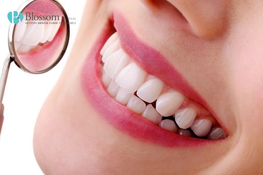 Mài răng bọc sứ có đau không? Có ảnh hưởng gì không? 5 mai rang boc su 4