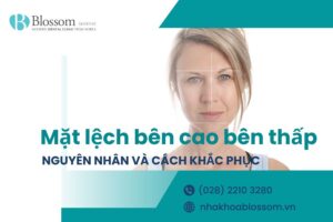 Mặt lệch bên cao bên thấp là tình trạng gì? Có thể khắc phục không?