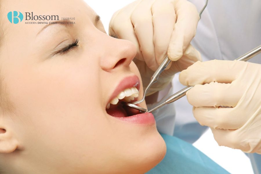 nen trong rang su hay implant 5