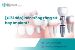 [Giải đáp] Nên trồng răng sứ hay Implant? – Nha Khoa Blossom