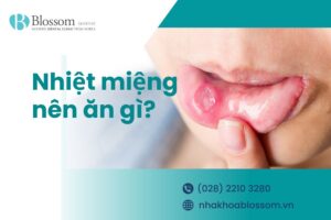 Nhiệt miệng là gì? Nhiệt miệng nên ăn gì?