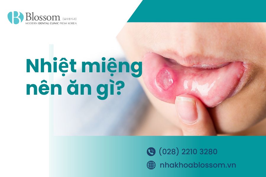 Nhiệt miệng là gì? Nhiệt miệng nên ăn gì? 1 nhiet mieng nen an gi thumbnail
