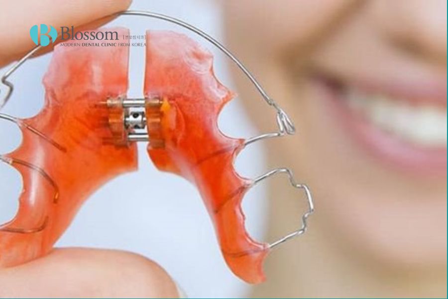 Nong hàm là gì? Đối tượng nào cần thực hiện? 6 nong ham la gi 6