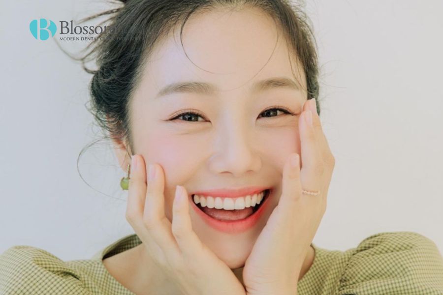 Nụ cười tỏa nắng là như thế nào? Phương pháp để có nụ cười tỏa nắng 2 nu cuoi toa nang la nhu the nao 1