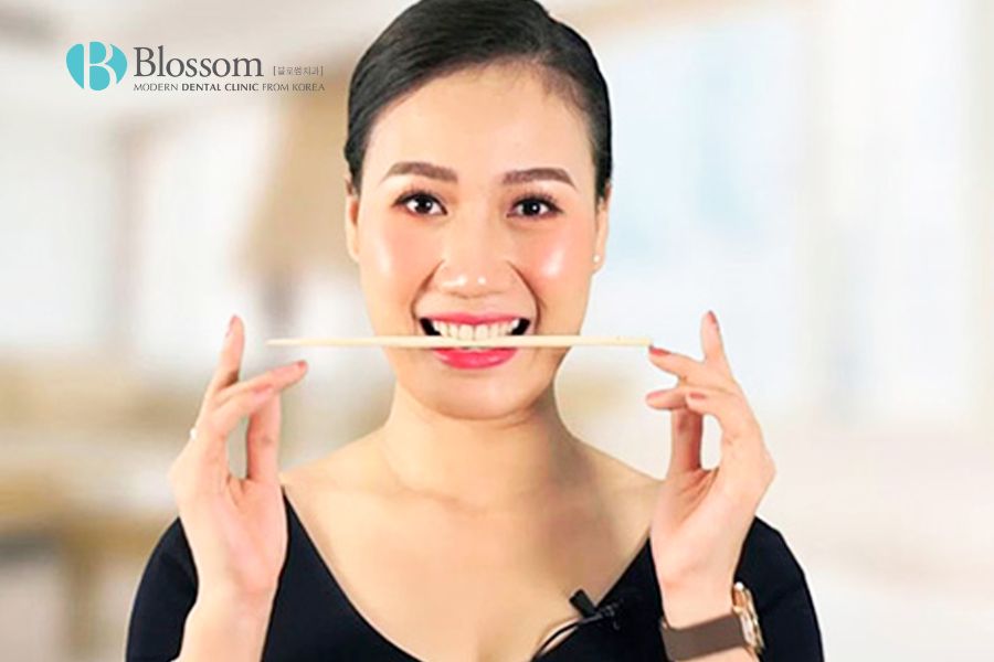 Nụ cười tỏa nắng là như thế nào? Phương pháp để có nụ cười tỏa nắng 8 nu cuoi toa nang la nhu the nao 5