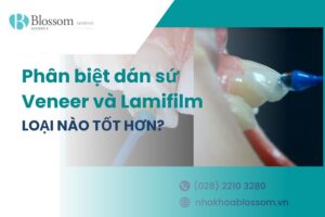 Phân biệt dán sứ Veneer và Lamifilm: Loại nào tốt hơn?