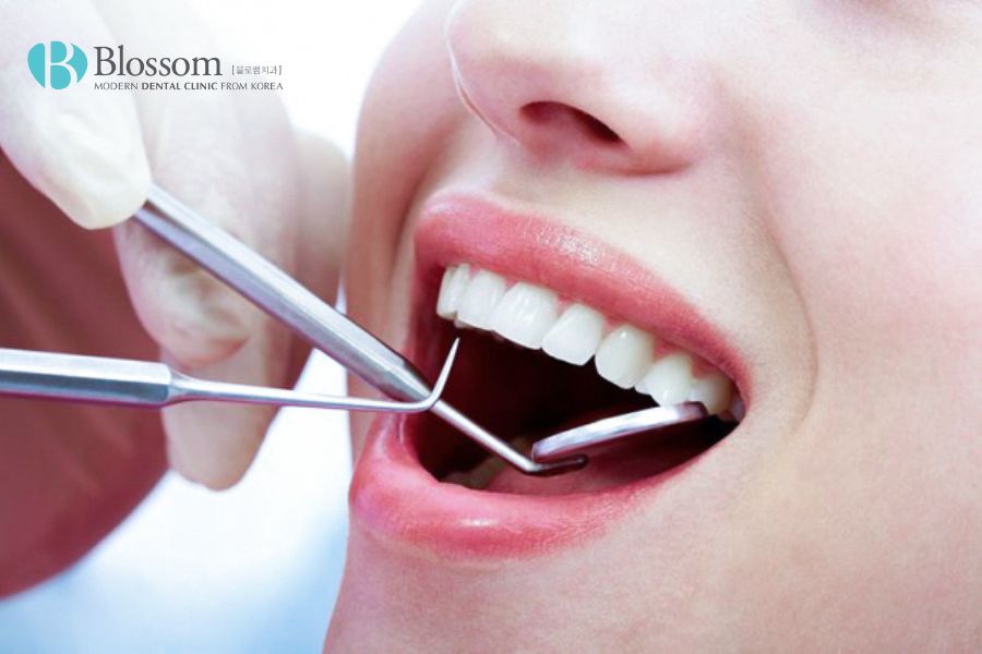 Hướng dẫn quy trình cắm Implant chi tiết, chuẩn Y khoa 2 quy trinh cam implant 1