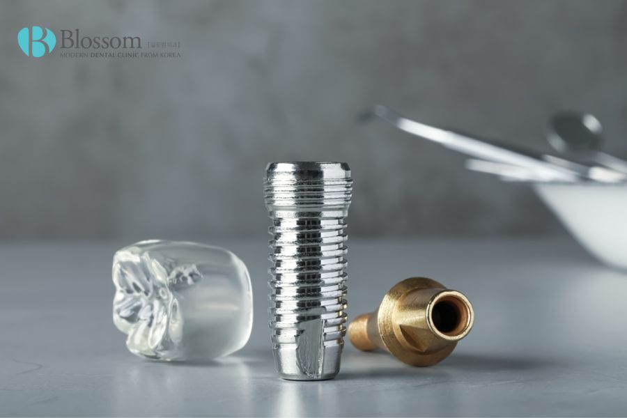 Hướng dẫn quy trình cắm Implant chi tiết, chuẩn Y khoa 12 quy trinh cam implant 11