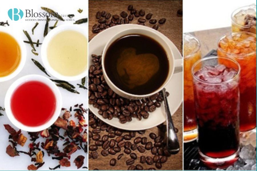 Răng xỉn màu là bị gì và cách khắc phục răng xỉn màu 3 rang bi xin mau 2