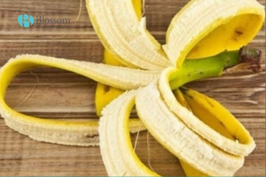 Răng xỉn màu là bị gì và cách khắc phục răng xỉn màu 10 rang bi xin mau 9