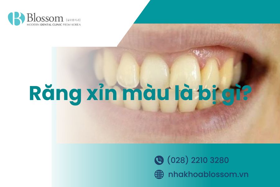 Răng xỉn màu là bị gì và cách khắc phục răng xỉn màu