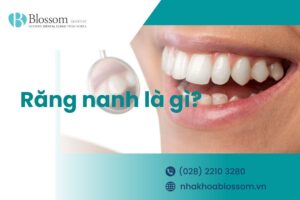 Răng nanh là gì? Đặc điểm nhận diện răng nanh