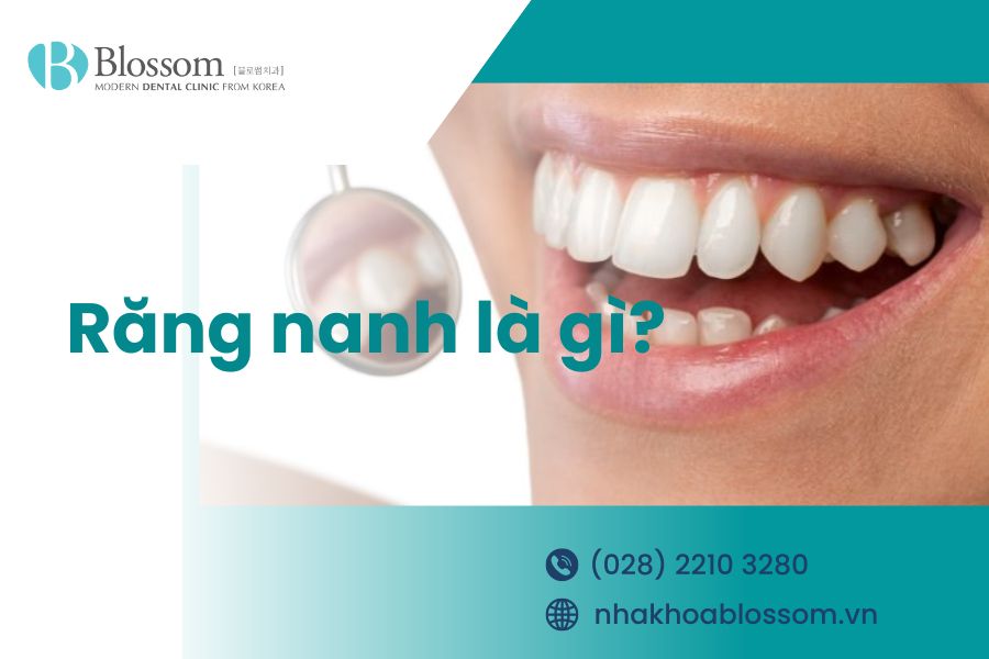 Răng nanh là gì? Đặc điểm nhận diện răng nanh
