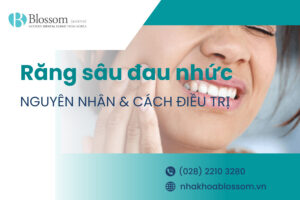 Răng sâu đau nhức là gì? Nguyên nhân và hướng điều trị ra sao?