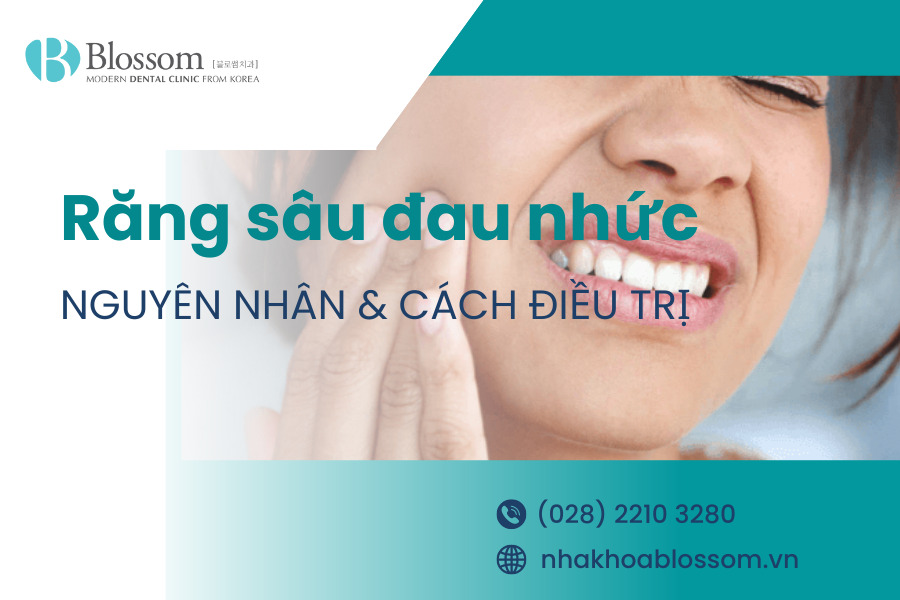 Răng sâu đau nhức là gì? Nguyên nhân và hướng điều trị ra sao? 1 rang sau dau nhuc thumbnail