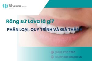 Răng sứ Lava là gì? Phân loại, quy trình và giá thành hiện nay