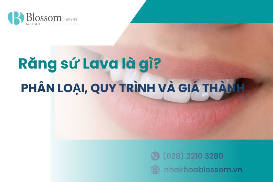 Răng sứ Lava là gì? Phân loại, quy trình và giá thành hiện nay