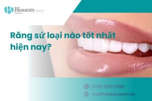 [Giải đáp thắc mắc] Răng sứ loại nào tốt nhất hiện nay?
