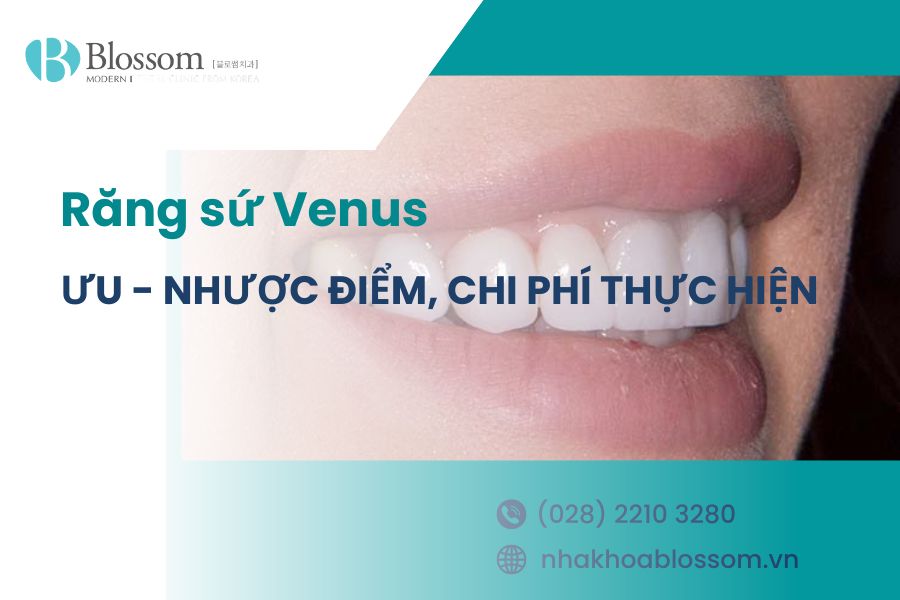 Răng sứ Venus: Ưu - nhược điểm, chi phí thực hiện 1 rang su venus thumbnail