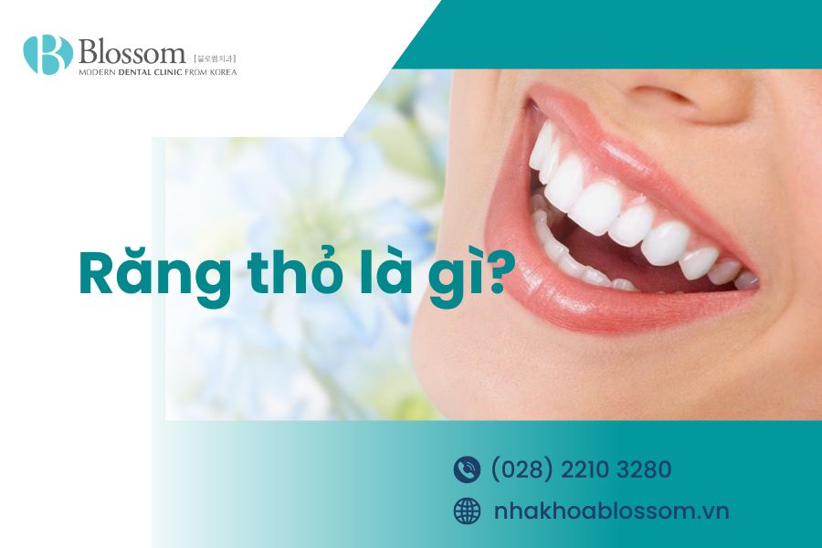Răng thỏ là gì? Răng thỏ có ý nghĩa gì?