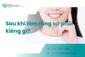 [Giải đáp] Sau khi làm răng sứ phải kiêng gì?