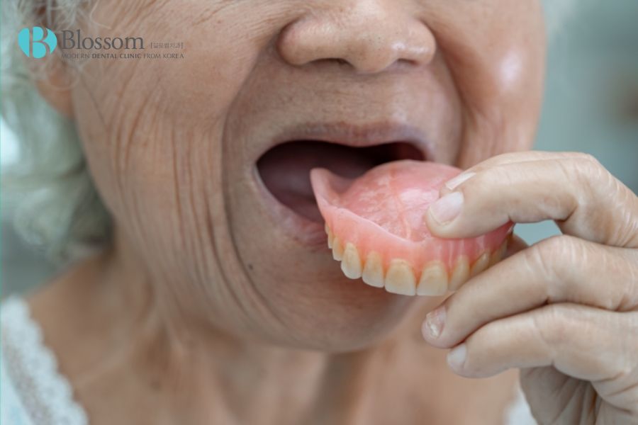 Trồng răng cho người lớn tuổi: Phương pháp nào tốt? 3 trong rang cho nguoi lon tuoi 2