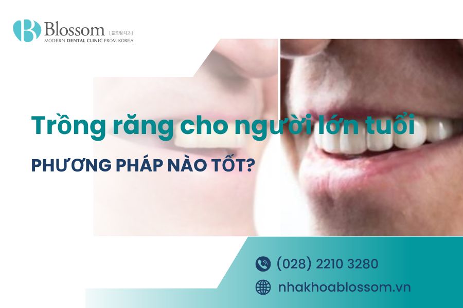 Trồng răng cho người lớn tuổi: Phương pháp nào tốt? 1 trong rang cho nguoi lon tuoi thumbnail