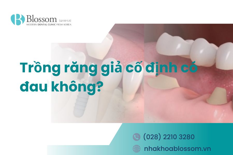 Trồng răng giả cố định có đau không? – Nha Khoa Blossom
